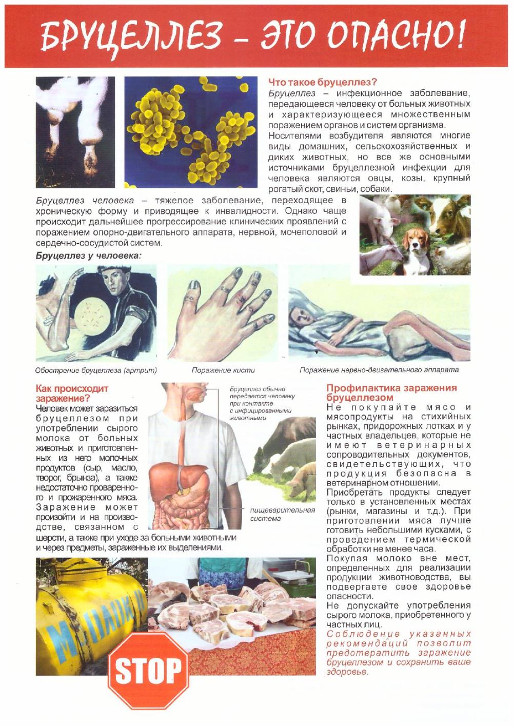 Бруцеллёз 